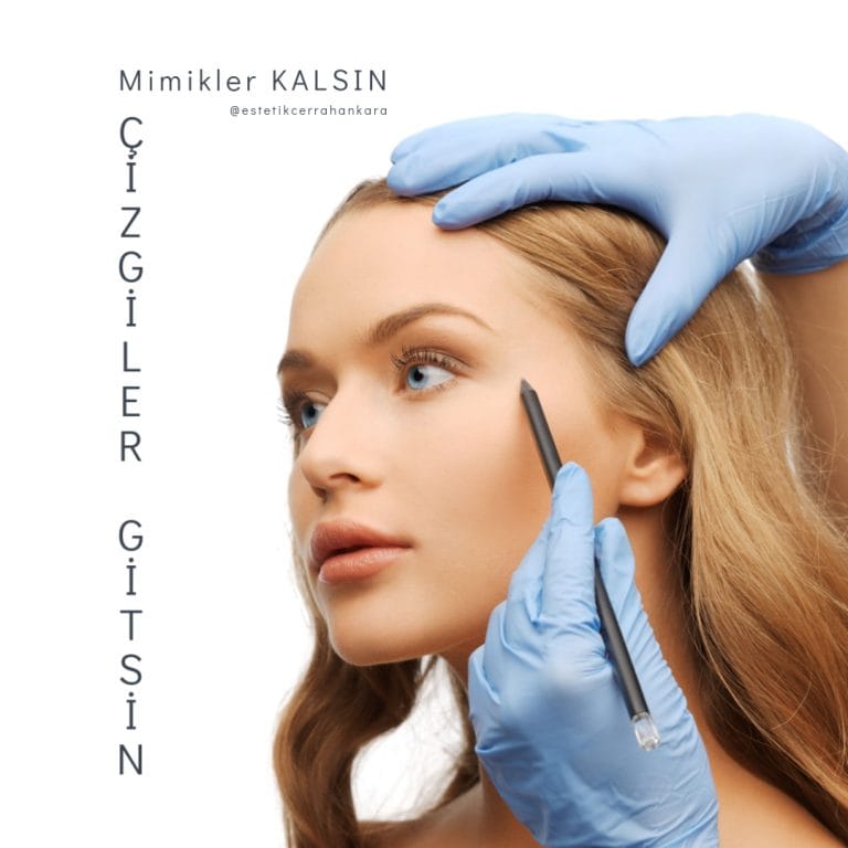 Botoks Ankara: Kişiye Özel Botox