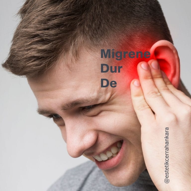 Migren botoksu