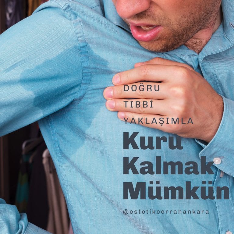Terleme botoksu