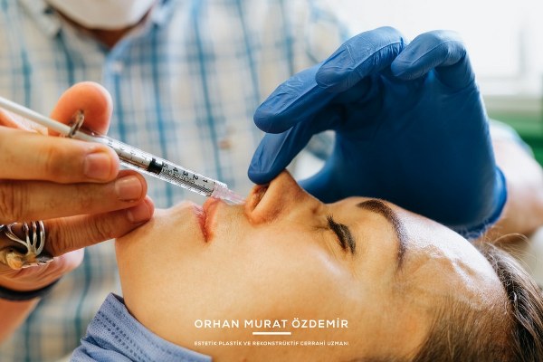 Burun botoksu uygulama bölgeleri — Op. Dr. Orhan Murat Özdemir, Ankara