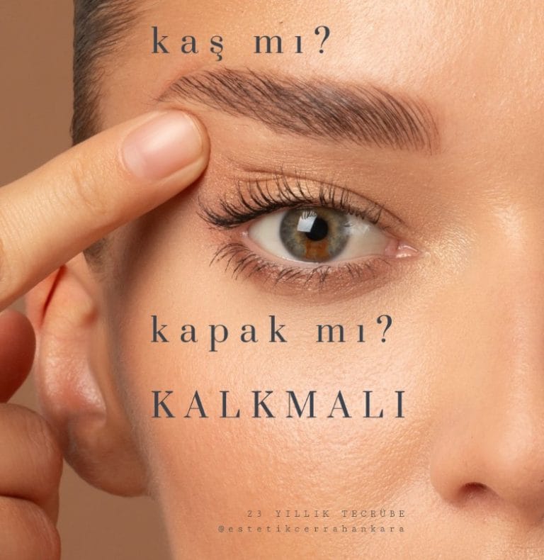 Kaş kaldırma
