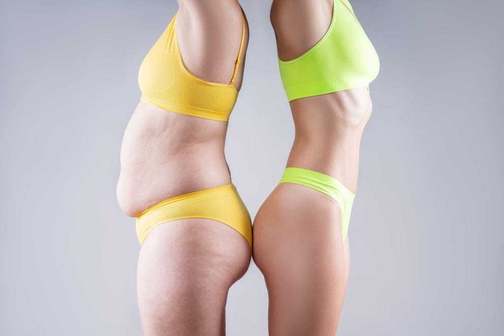 liposuction ankara fiyatları
