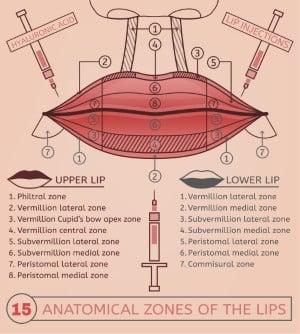 lip lift planlaması permalip kalıcı dudak dolgusu