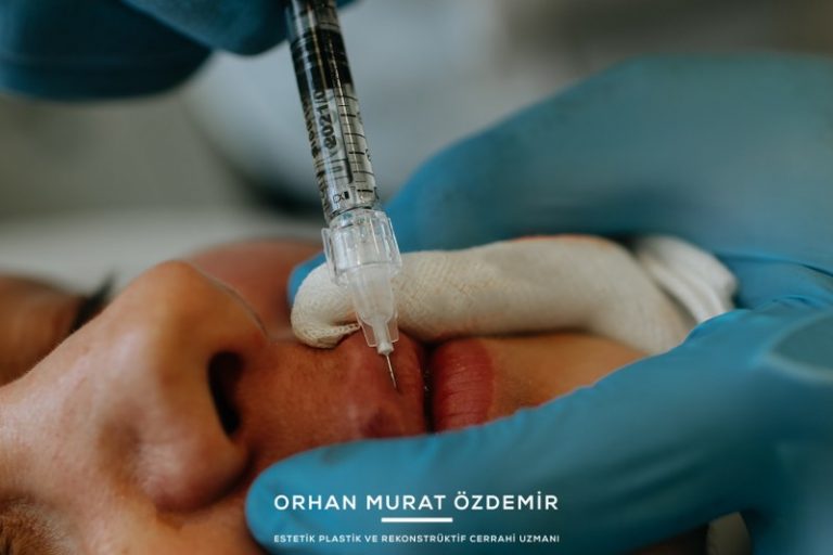 Dudak Dolgunlaştırma Yöntemleri