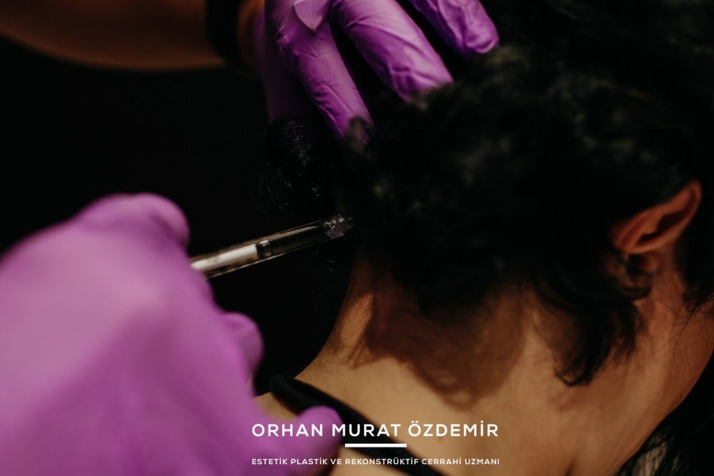 migren botoksu nerelere yapılır