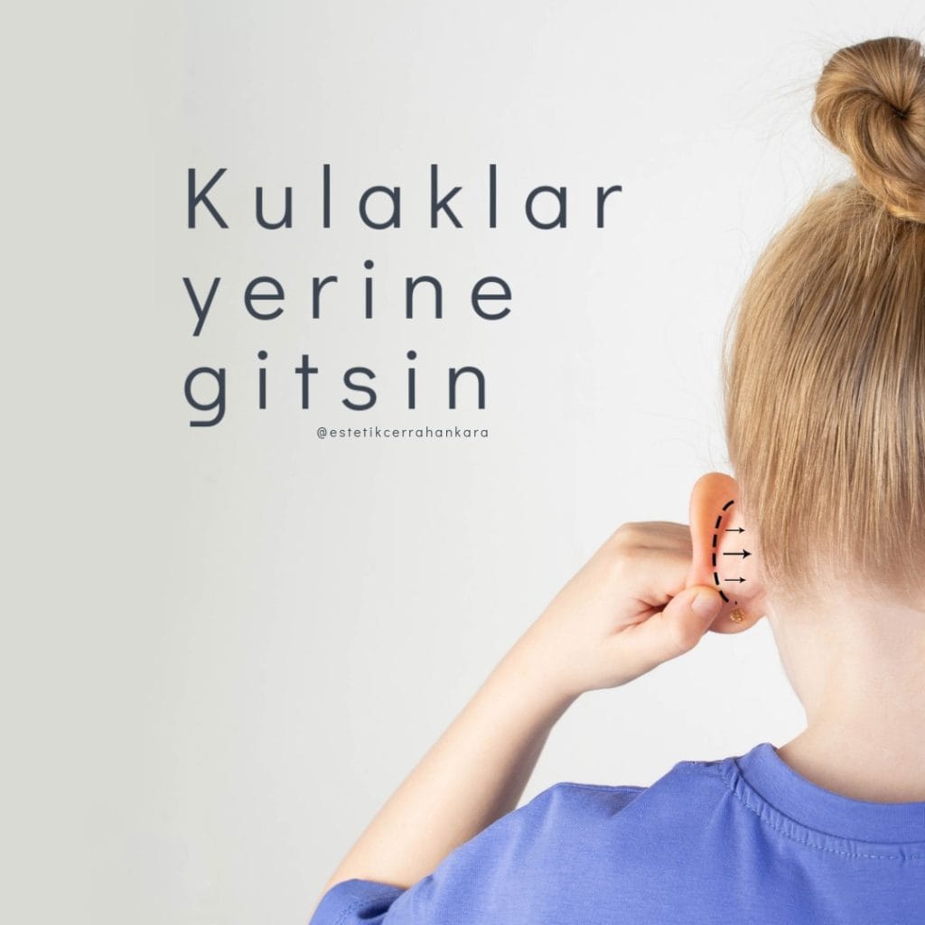 kulak estetigi fiyatlari 1