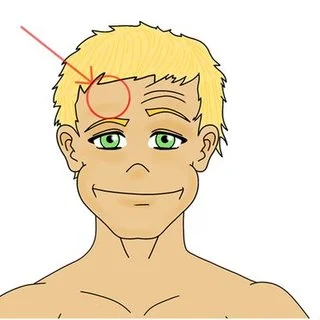 frontalis testi botoks neden tutmaz