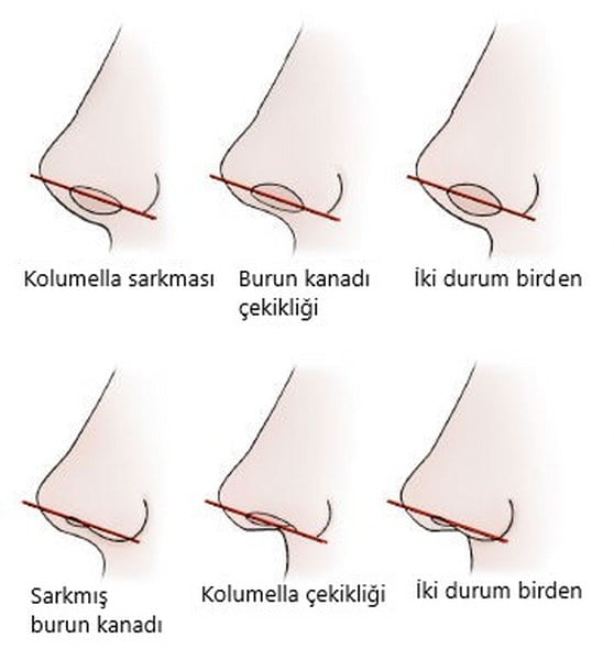 burun deliklerinin yandan görünmesi