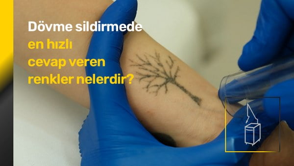 Q-Switched Lazer Dövme Sildirme 5 Hangi renkler daha hızlı cevap verir?